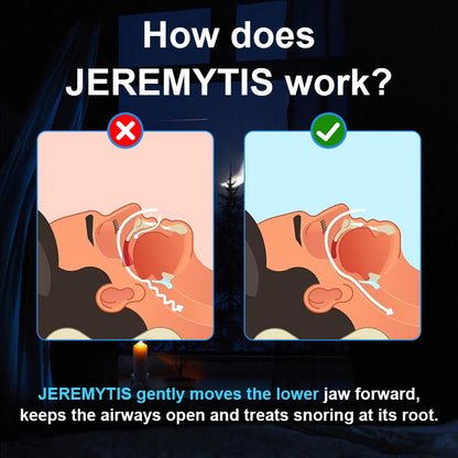 🔥[Official Brand Store] JEREMYTIS™ Adjustable Anti-Snoring Mouthpiece