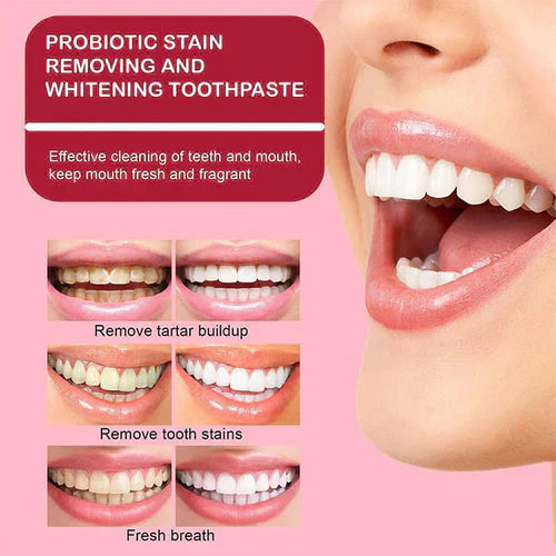 🔥2025 HOT SALE🔥 JEREMYTIS™  Probiotic Whitening Toothpaste