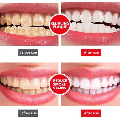 🔥2025 HOT SALE🔥 JEREMYTIS™  Probiotic Whitening Toothpaste