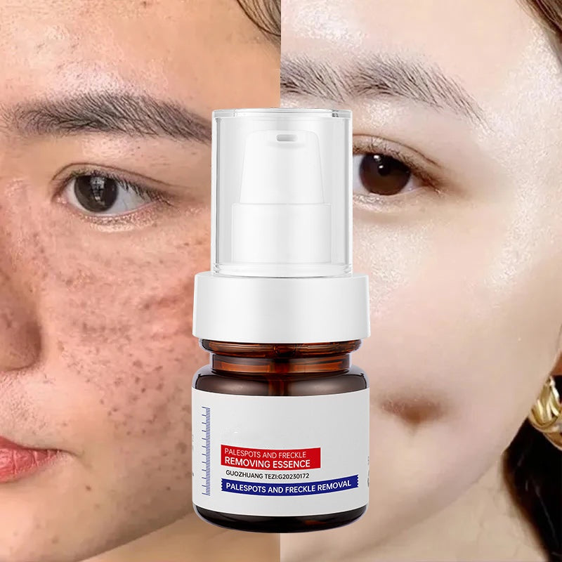 🔥FLASH SALE 50%：5-second brightening rescue: Dark spots disappear, blemishes fade, and skin becomes radiant! Vitamin C Whitening Freckles ESSENCE(3 HOURS LEFT!)
