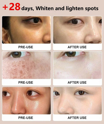 🔥Last Day 80%🔥Off-Niacinamide Purifying Whitening Cleanser