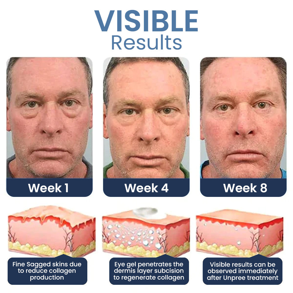 Grandparents Day Promotion🔥 Seurico™ PEPTIDE Depuffing Eye Serum 🔥 LAST DAY SALE 80% OFF 🔥