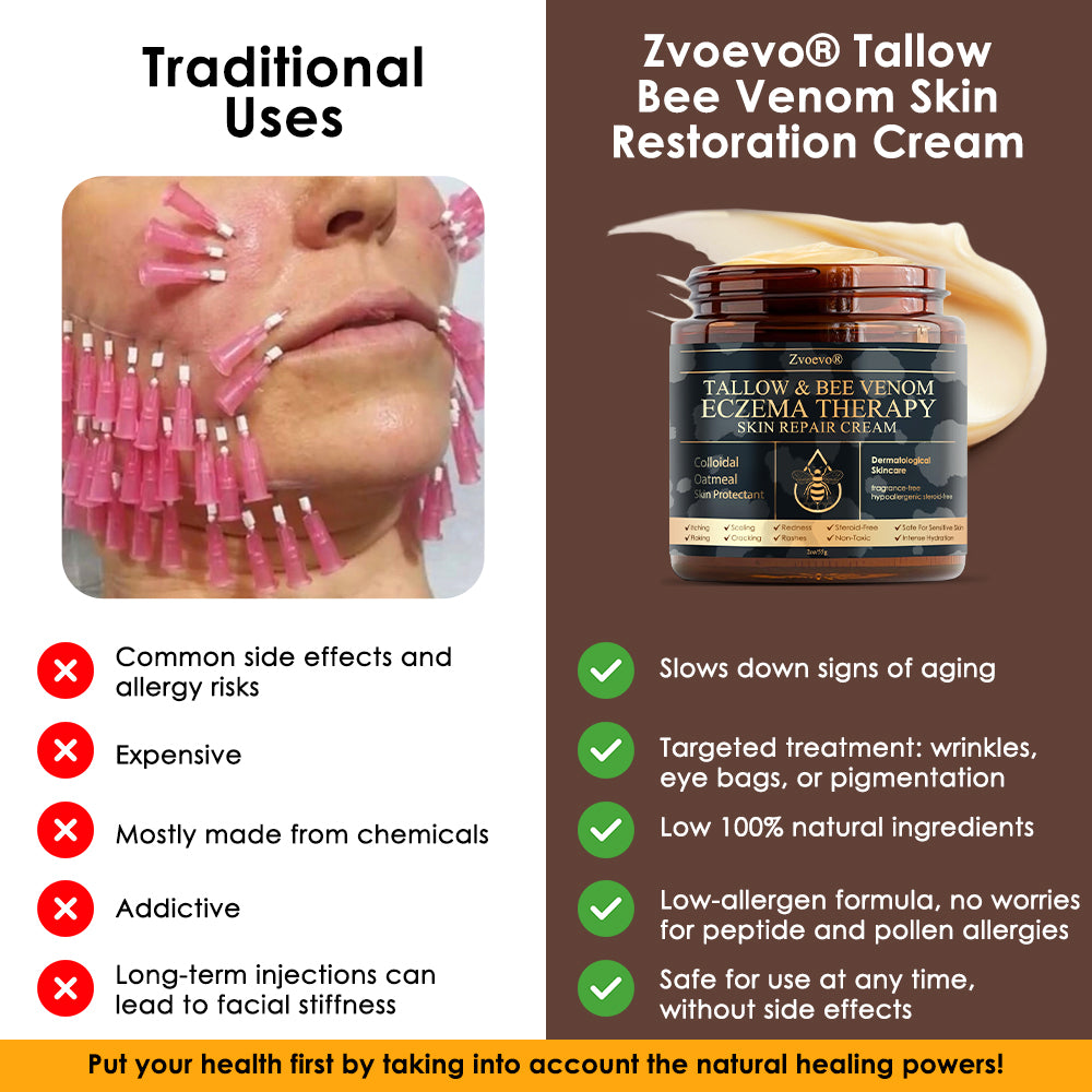 🇺🇸𝗚𝘂𝗮𝗿𝗮𝗻𝘁𝗲𝗲𝗱 𝗻𝗼 𝗿𝗲𝗰𝘂𝗿𝗿𝗲𝗻𝗰𝗲🌿𝐙𝐯𝐨𝐞𝐯𝐨® 𝐓𝐚𝐥𝐥𝐨𝐰 𝐁𝐞𝐞 𝐕𝐞𝐧𝐨𝐦 𝐒𝐤𝐢𝐧 𝐑𝐞𝐬𝐭𝐨𝐫𝐚𝐭𝐢𝐨𝐧 𝐂𝐫𝐞𝐚𝐦🇺🇸𝗠𝗮𝗱𝗲 𝗜𝗻 𝗨𝗦𝗔