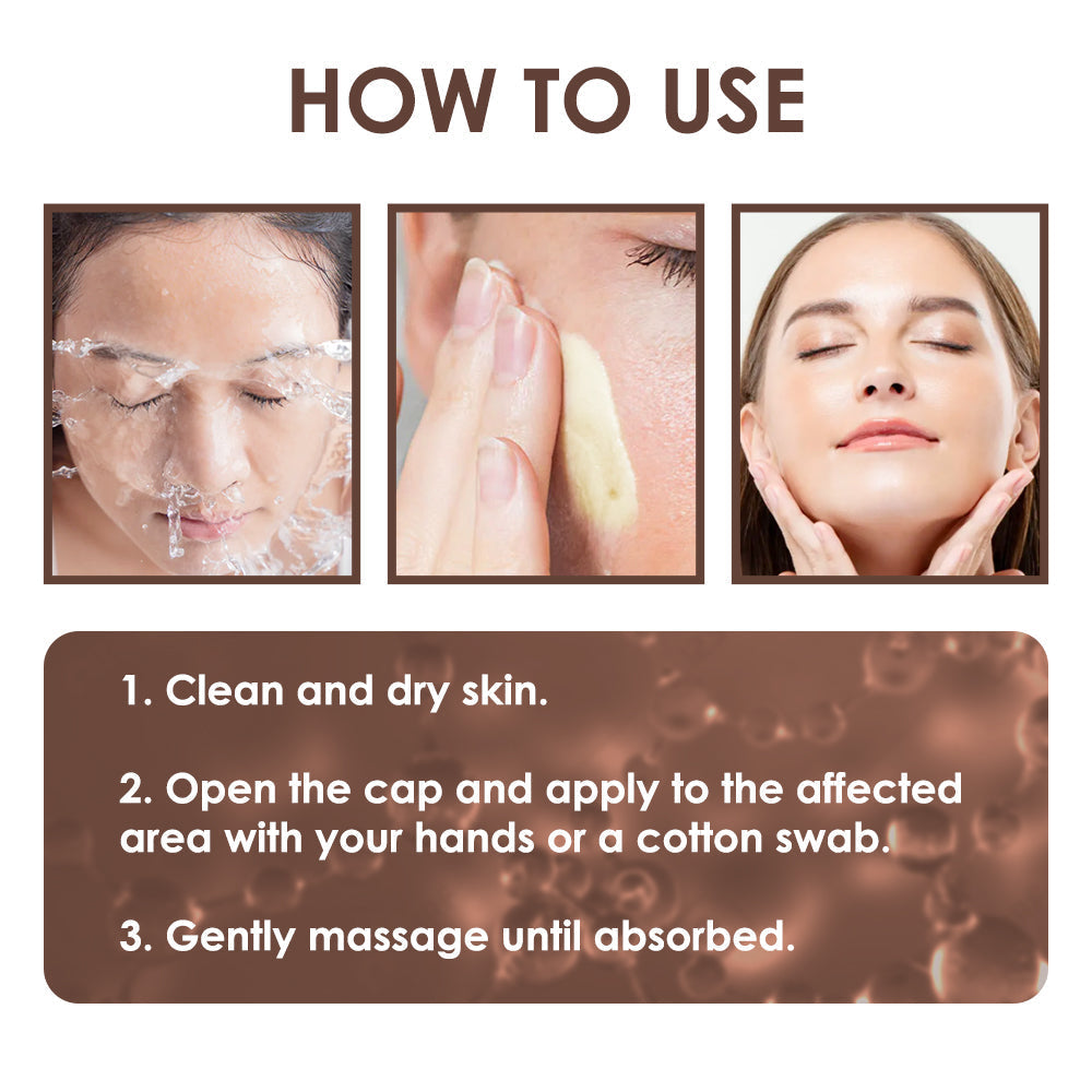 🇺🇸𝗚𝘂𝗮𝗿𝗮𝗻𝘁𝗲𝗲𝗱 𝗻𝗼 𝗿𝗲𝗰𝘂𝗿𝗿𝗲𝗻𝗰𝗲🌿𝐙𝐯𝐨𝐞𝐯𝐨® 𝐓𝐚𝐥𝐥𝐨𝐰 𝐁𝐞𝐞 𝐕𝐞𝐧𝐨𝐦 𝐒𝐤𝐢𝐧 𝐑𝐞𝐬𝐭𝐨𝐫𝐚𝐭𝐢𝐨𝐧 𝐂𝐫𝐞𝐚𝐦🇺🇸𝗠𝗮𝗱𝗲 𝗜𝗻 𝗨𝗦𝗔