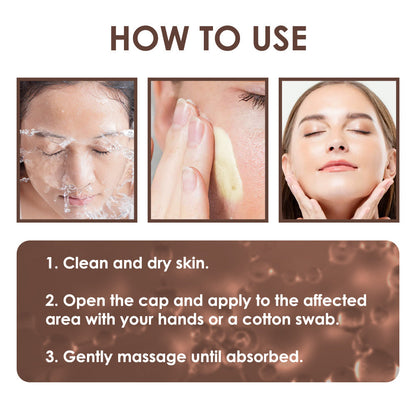 🇺🇸𝗚𝘂𝗮𝗿𝗮𝗻𝘁𝗲𝗲𝗱 𝗻𝗼 𝗿𝗲𝗰𝘂𝗿𝗿𝗲𝗻𝗰𝗲🌿𝐙𝐯𝐨𝐞𝐯𝐨® 𝐓𝐚𝐥𝐥𝐨𝐰 𝐁𝐞𝐞 𝐕𝐞𝐧𝐨𝐦 𝐒𝐤𝐢𝐧 𝐑𝐞𝐬𝐭𝐨𝐫𝐚𝐭𝐢𝐨𝐧 𝐂𝐫𝐞𝐚𝐦🇺🇸𝗠𝗮𝗱𝗲 𝗜𝗻 𝗨𝗦𝗔