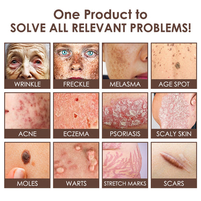 🇺🇸𝗚𝘂𝗮𝗿𝗮𝗻𝘁𝗲𝗲𝗱 𝗻𝗼 𝗿𝗲𝗰𝘂𝗿𝗿𝗲𝗻𝗰𝗲🌿𝐙𝐯𝐨𝐞𝐯𝐨® 𝐓𝐚𝐥𝐥𝐨𝐰 𝐁𝐞𝐞 𝐕𝐞𝐧𝐨𝐦 𝐒𝐤𝐢𝐧 𝐑𝐞𝐬𝐭𝐨𝐫𝐚𝐭𝐢𝐨𝐧 𝐂𝐫𝐞𝐚𝐦🇺🇸𝗠𝗮𝗱𝗲 𝗜𝗻 𝗨𝗦𝗔