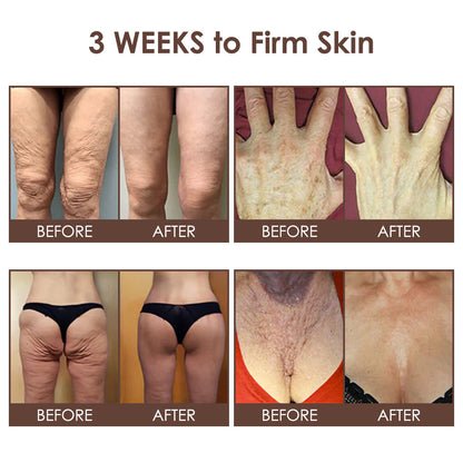 🇺🇸𝗚𝘂𝗮𝗿𝗮𝗻𝘁𝗲𝗲𝗱 𝗻𝗼 𝗿𝗲𝗰𝘂𝗿𝗿𝗲𝗻𝗰𝗲🌿𝐙𝐯𝐨𝐞𝐯𝐨® 𝐓𝐚𝐥𝐥𝐨𝐰 𝐁𝐞𝐞 𝐕𝐞𝐧𝐨𝐦 𝐒𝐤𝐢𝐧 𝐑𝐞𝐬𝐭𝐨𝐫𝐚𝐭𝐢𝐨𝐧 𝐂𝐫𝐞𝐚𝐦🇺🇸𝗠𝗮𝗱𝗲 𝗜𝗻 𝗨𝗦𝗔