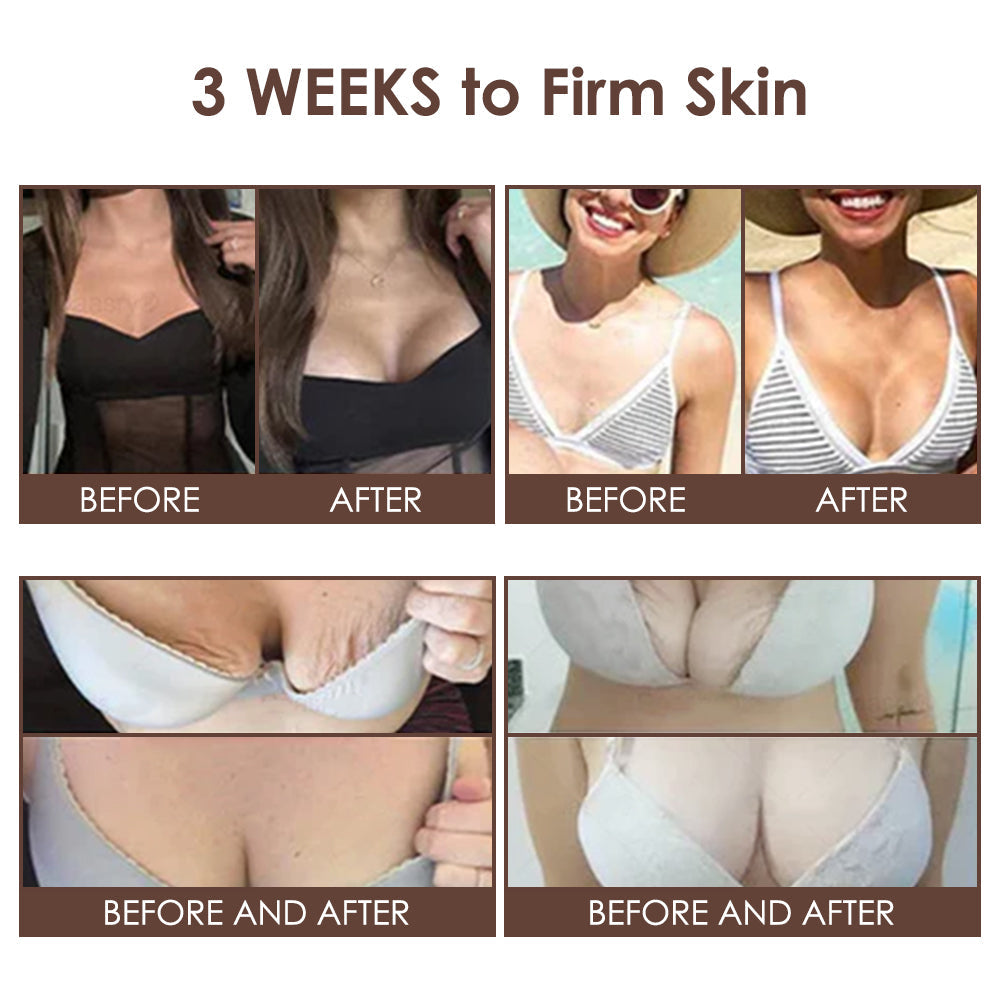 🇺🇸𝗚𝘂𝗮𝗿𝗮𝗻𝘁𝗲𝗲𝗱 𝗻𝗼 𝗿𝗲𝗰𝘂𝗿𝗿𝗲𝗻𝗰𝗲🌿𝐙𝐯𝐨𝐞𝐯𝐨® 𝐓𝐚𝐥𝐥𝐨𝐰 𝐁𝐞𝐞 𝐕𝐞𝐧𝐨𝐦 𝐒𝐤𝐢𝐧 𝐑𝐞𝐬𝐭𝐨𝐫𝐚𝐭𝐢𝐨𝐧 𝐂𝐫𝐞𝐚𝐦🇺🇸𝗠𝗮𝗱𝗲 𝗜𝗻 𝗨𝗦𝗔