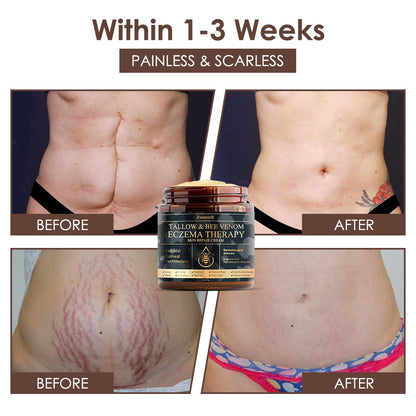 🇺🇸𝗚𝘂𝗮𝗿𝗮𝗻𝘁𝗲𝗲𝗱 𝗻𝗼 𝗿𝗲𝗰𝘂𝗿𝗿𝗲𝗻𝗰𝗲🌿𝐙𝐯𝐨𝐞𝐯𝐨® 𝐓𝐚𝐥𝐥𝐨𝐰 𝐁𝐞𝐞 𝐕𝐞𝐧𝐨𝐦 𝐒𝐤𝐢𝐧 𝐑𝐞𝐬𝐭𝐨𝐫𝐚𝐭𝐢𝐨𝐧 𝐂𝐫𝐞𝐚𝐦🇺🇸𝗠𝗮𝗱𝗲 𝗜𝗻 𝗨𝗦𝗔