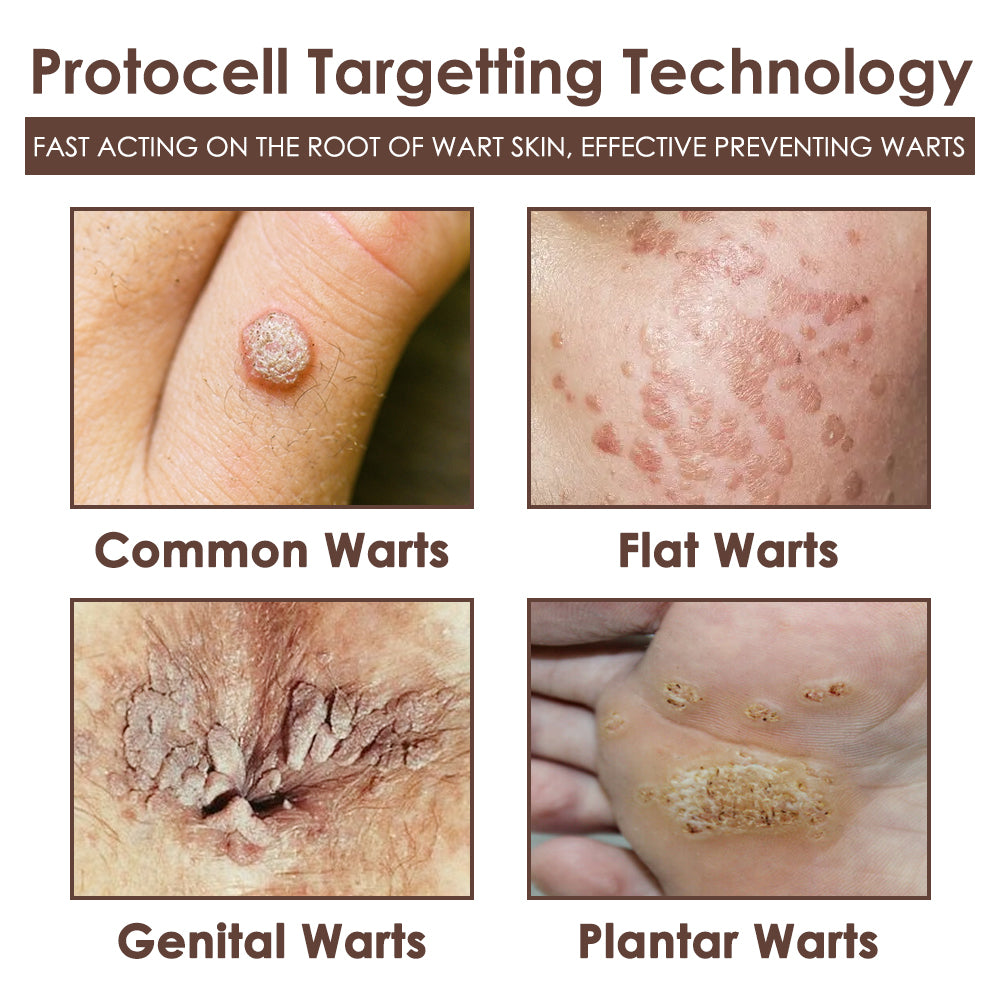 🇺🇸𝗚𝘂𝗮𝗿𝗮𝗻𝘁𝗲𝗲𝗱 𝗻𝗼 𝗿𝗲𝗰𝘂𝗿𝗿𝗲𝗻𝗰𝗲🌿𝐙𝐯𝐨𝐞𝐯𝐨® 𝐓𝐚𝐥𝐥𝐨𝐰 𝐁𝐞𝐞 𝐕𝐞𝐧𝐨𝐦 𝐒𝐤𝐢𝐧 𝐑𝐞𝐬𝐭𝐨𝐫𝐚𝐭𝐢𝐨𝐧 𝐂𝐫𝐞𝐚𝐦🇺🇸𝗠𝗮𝗱𝗲 𝗜𝗻 𝗨𝗦𝗔