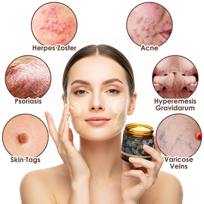 🇺🇸𝗚𝘂𝗮𝗿𝗮𝗻𝘁𝗲𝗲𝗱 𝗻𝗼 𝗿𝗲𝗰𝘂𝗿𝗿𝗲𝗻𝗰𝗲🌿𝐙𝐯𝐨𝐞𝐯𝐨® 𝐓𝐚𝐥𝐥𝐨𝐰 𝐁𝐞𝐞 𝐕𝐞𝐧𝐨𝐦 𝐒𝐤𝐢𝐧 𝐑𝐞𝐬𝐭𝐨𝐫𝐚𝐭𝐢𝐨𝐧 𝐂𝐫𝐞𝐚𝐦🇺🇸𝗠𝗮𝗱𝗲 𝗜𝗻 𝗨𝗦𝗔