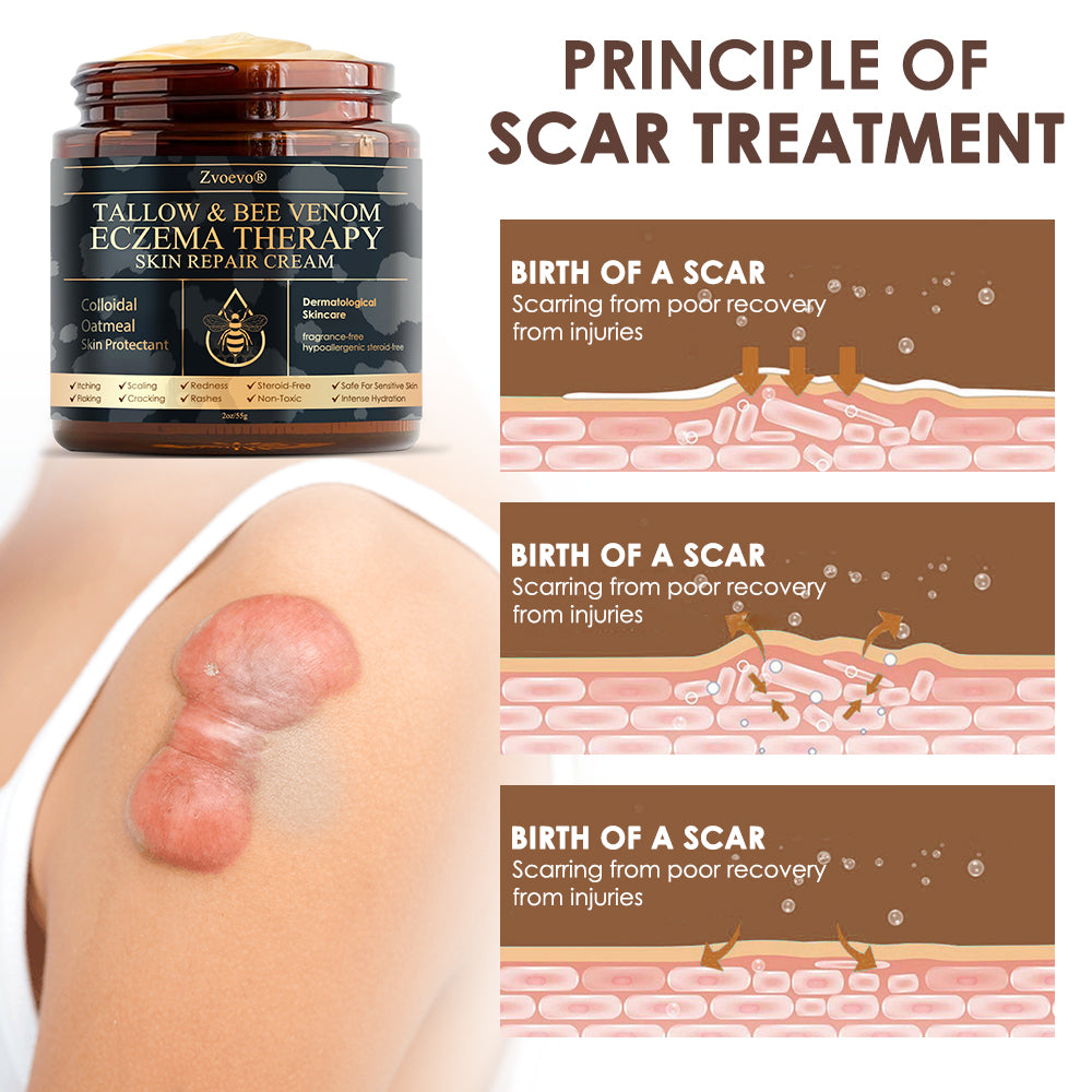 🇺🇸𝗚𝘂𝗮𝗿𝗮𝗻𝘁𝗲𝗲𝗱 𝗻𝗼 𝗿𝗲𝗰𝘂𝗿𝗿𝗲𝗻𝗰𝗲🌿𝐙𝐯𝐨𝐞𝐯𝐨® 𝐓𝐚𝐥𝐥𝐨𝐰 𝐁𝐞𝐞 𝐕𝐞𝐧𝐨𝐦 𝐒𝐤𝐢𝐧 𝐑𝐞𝐬𝐭𝐨𝐫𝐚𝐭𝐢𝐨𝐧 𝐂𝐫𝐞𝐚𝐦🇺🇸𝗠𝗮𝗱𝗲 𝗜𝗻 𝗨𝗦𝗔