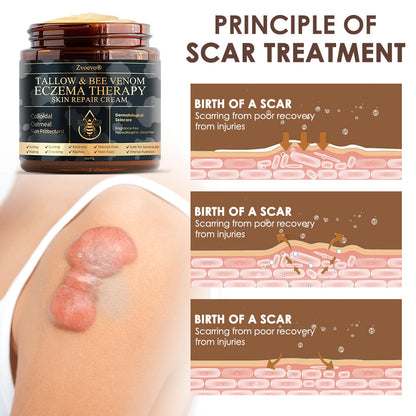 🇺🇸𝗚𝘂𝗮𝗿𝗮𝗻𝘁𝗲𝗲𝗱 𝗻𝗼 𝗿𝗲𝗰𝘂𝗿𝗿𝗲𝗻𝗰𝗲🌿𝐙𝐯𝐨𝐞𝐯𝐨® 𝐓𝐚𝐥𝐥𝐨𝐰 𝐁𝐞𝐞 𝐕𝐞𝐧𝐨𝐦 𝐒𝐤𝐢𝐧 𝐑𝐞𝐬𝐭𝐨𝐫𝐚𝐭𝐢𝐨𝐧 𝐂𝐫𝐞𝐚𝐦🇺🇸𝗠𝗮𝗱𝗲 𝗜𝗻 𝗨𝗦𝗔