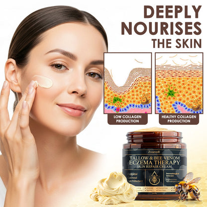 🇺🇸𝗚𝘂𝗮𝗿𝗮𝗻𝘁𝗲𝗲𝗱 𝗻𝗼 𝗿𝗲𝗰𝘂𝗿𝗿𝗲𝗻𝗰𝗲🌿𝐙𝐯𝐨𝐞𝐯𝐨® 𝐓𝐚𝐥𝐥𝐨𝐰 𝐁𝐞𝐞 𝐕𝐞𝐧𝐨𝐦 𝐒𝐤𝐢𝐧 𝐑𝐞𝐬𝐭𝐨𝐫𝐚𝐭𝐢𝐨𝐧 𝐂𝐫𝐞𝐚𝐦🇺🇸𝗠𝗮𝗱𝗲 𝗜𝗻 𝗨𝗦𝗔