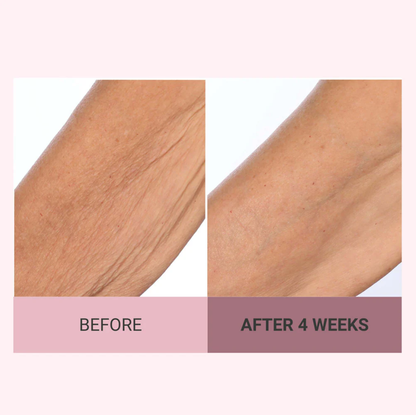 💆‍♀️ Experience Ultimate Luxury - 50% OFF - ✨ Champagne Beaute Lift Firming Body Cream - For Firmer, Smoother, Radiant Skin! 🌟（Buy 3 & Free Shipping）